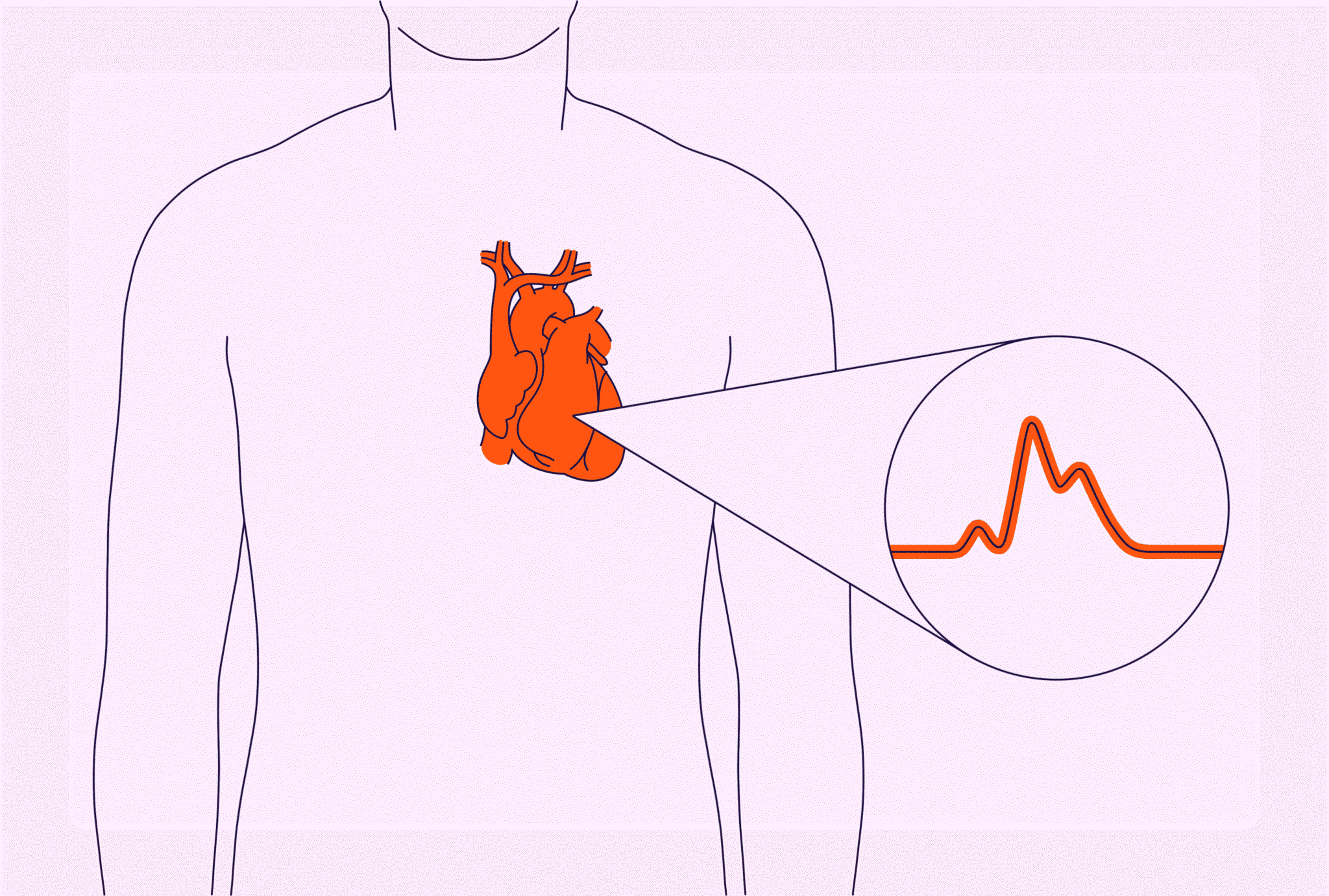 Understanding Cardiac Arrest, Heart Attack, and Stroke