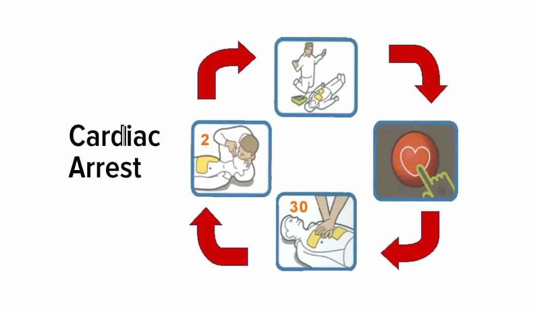 Cardiac arrest 1