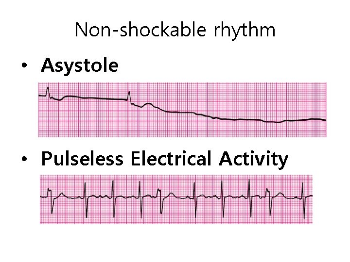 Non shockable rhythms