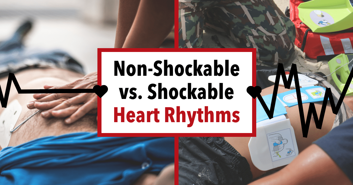 Shockable vs. Non-Shockable Heart Rhythms 