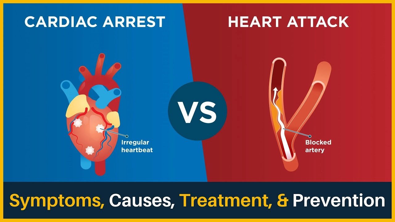Heart attack vs cardiac arrest or stroke